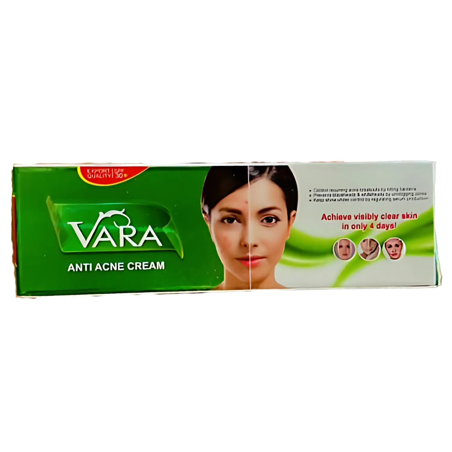 VARA ANTI ACNE CREAM Glimm Glory